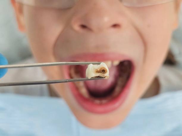 Best Mobile Emergency Dentist in Orting, WA
